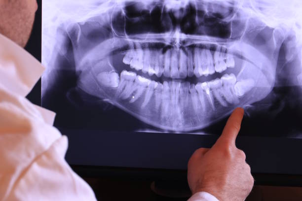 Best Dentist for Tooth Abscess  in Rosemont, PA