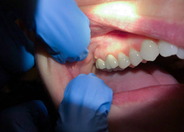 Best Emergency Dentist Near Me  in Rosemont, PA